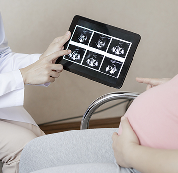 Ultrasonido de Flujos Doppler